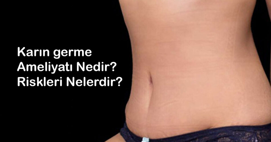 Abdominoplasty